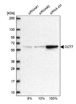 TCP1-eta Antibody, Novus Biologicals 25 &mu;L; Unlabeled:Antibodies, Polyclonal